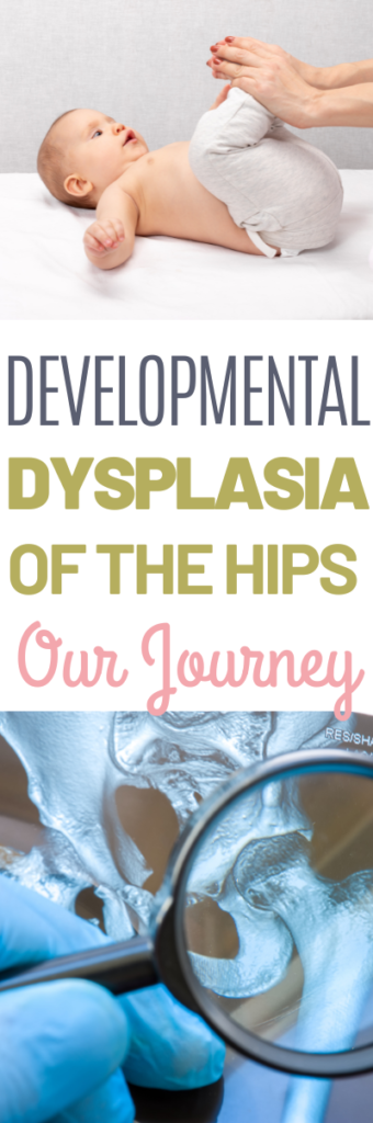 Developmental Dysplasia of the Hips - Our Journey Begins!